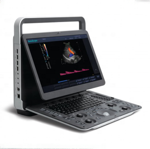 SonoScape vétérinaire ecocardiografo Machine à ultrasons doppler couleur vétérinaire portable E2vet - Product Image 1