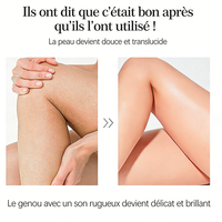 Savon blanchissant artisanal aux herbes en gros, savon de bain et de toilette fait main, produits blanchissants pour la peau, savon de luxe