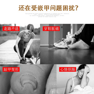 Toenail Corrector Straightener Nail Wire Pedicure Tool Silver Gold Color <b>Box</b> Portable Simple Style - Product Image 1