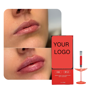 Gel injectable pour les lèvres, sûr et doux, 1 ml, rouge, <span class=keywords><strong>acide</strong></span> <span class=keywords><strong>hyaluronique</strong></span> + vitamine B12, crée un effet naturel de rouge à lèvres, <span class=keywords><strong>prix</strong></span> de gros d'usine - Product Image 5