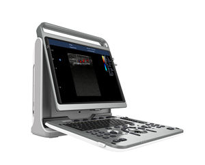 <span class=keywords><strong>Chison</strong></span> Ebit50 Instruments à ultrasons médicaux portables 4d, <span class=keywords><strong>Machine</strong></span> à ultrasons - Product Image 3