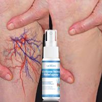 Spray de Soin des Mains et des Pieds en Gros pour le Soulagement des Varices, Spray de Soin des Pieds Contre les Varices