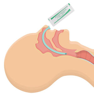 ORI-POWER – Tube nasopharyngé manuel jetable médical homologué CE – Classe II – Diverses tailles (20Fr-36Fr) – Premiers secours d'urgence - Product Image 4