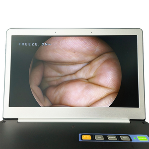 Draagbare Alles In Één Hd Fhd 1080P Chirurgische Medische Endoscoop Camera Voor Ent/Laparoscopie/Hysteroscopie/Urologie Chirurgie - Product Image 5