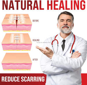 Tiras de Cierre de Heridas de Emergencia YOJO, 3 Aplicaciones Fáciles, Bandas Adhesivas Tipo Mariposa, Kit de Cierre de Laceraciones Sin Costuras e Indoloro, Desinfección con EO - Product Image 5