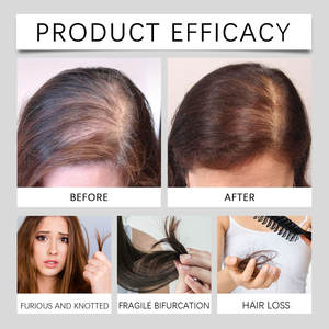 OEM 120 Ml aceite de coco Champú para el cabello Control de aceite Anti-pérdida de cabello Champú y acondicionador para el cuidado del cabello - Product Image 2