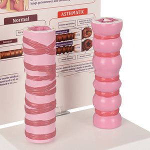 Modè<span class=keywords><strong>le</strong></span> d'asthme KyrenMed : Comparaison entre bronches normales <span class=keywords><strong>et</strong></span> pathologiques avec explications - Product Image 2