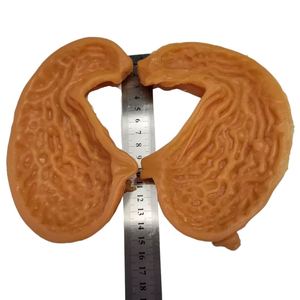 KyrenMed 3D modèle d'anastomose gastrique humaine modèle d'entraînement de l'estomac bivalve silicone grandeur nature pour la pratique de la chirurgie générale - Product Image 1
