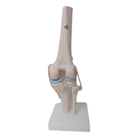 Science médicale arthrose anatomie pathologique PVC artificiel flexible taille réelle squelette humain modèle anatomique de l'articulation du genou