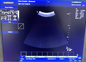 Sistem Ultrasound Veteriner B/W Berkualitas Tinggi dan Murah, Perangkat Ultrasound <span class=keywords><strong>Doppler</strong></span> - Product Image 4