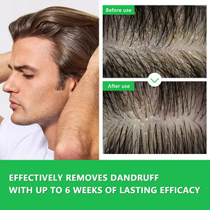 Champú Clínico para la Caspa con <span class=keywords><strong>Sulfuro</strong></span> <span class=keywords><strong>de</strong></span> Selenio y Piritionato <span class=keywords><strong>de</strong></span> <span class=keywords><strong>Zinc</strong></span> - Tratamiento Antifúngico para el Cuero Cabelludo Seco y con Picazón, Alivio Intenso - Product Image 3