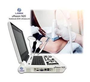 LANNX uRason N20 produsen laptop portabel, mesin ultrasound B/W Digital penuh Doppler USG sistem diagnostik untuk ginekologi