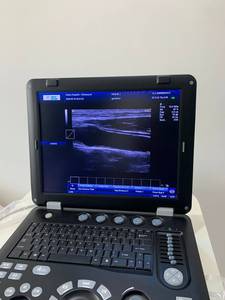 Appareil d'échographie cardiaque <span class=keywords><strong>portable</strong></span> CE, échographie 2D, échographie cardiaque 3D, échographie <span class=keywords><strong>Doppler</strong></span> couleur - Product Image 6