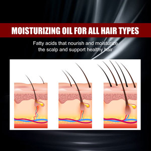 Sérum Capillaire Naturel au Gingembre et Riz Noir de Marque Privée – Huile de Croissance Anti-Chute pour Hommes et <span class=keywords><strong>Femmes</strong></span> - Product Image 3