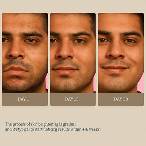 Etiqueta privada limón cúrcuma y Ácido Kójico jabón brillo jabón Original vitamina C hecho a mano cúrcuma limón jabón - Product Image 4