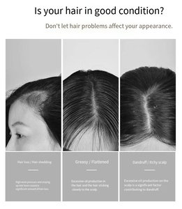 Tratamiento Capilar Avanzado con ADN para Hidratar, Calmar y Fortalecer el Cuero Cabelludo, Sérum para el Cuidado del Cabello <span class=keywords><strong>Yogoo</strong></span>, Venta al Por Mayor - Product Image 3