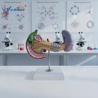 Modelo de anatomía del cuerpo humano, enfermedades del páncreas y la médula, modelo de enseñanza médica patológica