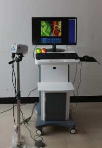 होशे चिकित्सा उच्च परिभाषा और फास्ट-इमेजिंग स्त्री रोग वीडियो कोलोपोस्कोप अस्पताल-उपयोग - Product Image 5