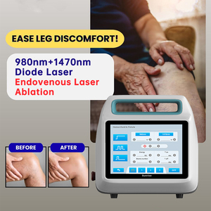 <span class=keywords><strong>Precio</strong></span> del <span class=keywords><strong>tratamiento</strong></span> EVLT/EVLA para venas varicosas endovenosas con ablación endovascular de 980 y 1470nm en Beijing Sunrise - Product Image 3
