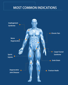 Máquina de Terapia de Anillo Magnético de Inducción de Alta Energía Mejorada para Alivio del Dolor Corporal, Portátil, de ABS, para Protección del Tejido Muscular y Óseo - Product Image 5