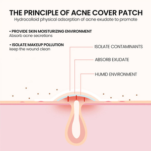 Patchs Hydrocolloïdes Invisibles et Imperméables pour l'Acné et les Boutons, en Gros, avec Vitamine C et Hydratant à l'Aloe Vera - Product Image 4