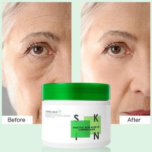 Mascarilla Facial Suave, Hidratante y Nutritiva para el Cuidado de la Piel, Reafirmante, con Ácido Salicílico para el Control del Acné - Product Image 4