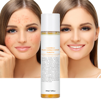 Tonique Hydratant Non Gras à l'Extrait de Calendula pour Peaux Grasses, Blanchissant et Biologique, Marque Privée du Fabricant