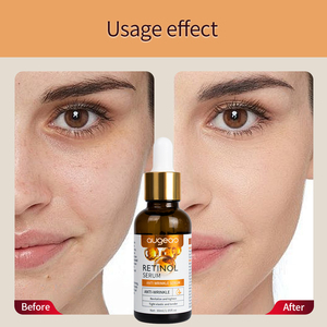 Soin de la peau, éclaircissement des taches brunes, anti-âge, sérum facial au rétinol, blanchiment du visage, sérum pour la peau - Product Image 2