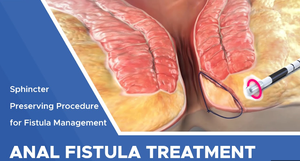 Private Label 980 1470nm Soins de santé Saignement Hémorroïdes Brûlant Gonflement Douleur <span class=keywords><strong>Anus</strong></span> Traitement Soulagement Douleur Hémorroïdes Pommade - Product Image 3