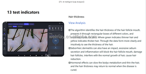 เครื่องวิเคราะห์เส้นผมใหม่เครื่องวิเคราะห์หนังศีรษะเครื่องวิเคราะห์เครื่องสแกนใบหน้าเครื่องสแกนใบหน้าเครื่องวิเคราะห์หนังศีรษะมหัศจรรย์ - Product Image 2