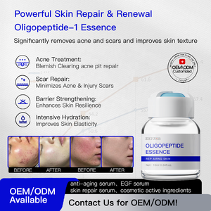 Traitement de l'acné à l'oligopeptide-1 <span class=keywords><strong>pour</strong></span> 10 ml <span class=keywords><strong>pour</strong></span> le visage <span class=keywords><strong>et</strong></span> le corps Réduction des pores Cicatrices d'acné Réparation de la barrière cutanée Tout type de <span class=keywords><strong>peau</strong></span> - Product Image 2