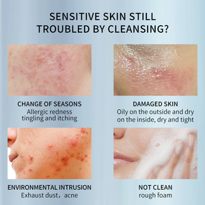<span class=keywords><strong>Toleriane</strong></span> biologico a base di erbe schiumogeno <span class=keywords><strong>detergente</strong></span> <span class=keywords><strong>viso</strong></span> vitamina Niacina olio-lavaggio del <span class=keywords><strong>viso</strong></span> per l'invecchiamento della pelle grassa e sensibile per la pelle secca - Product Image 2