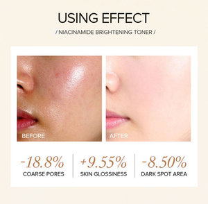Set Glass Skin all'Ingrosso con Detergente Tonico Siero Crema Anti-Età Illuminante Riparatore Ringiovanente Sbiancante Cura della Pelle Coreana <span class=keywords><strong>per</strong></span> Donna - Product Image 3