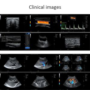 Mesin Ultrasound dokter hewan MECANMED Harga Ultrasonido portabel portabel Bovino peralatan Ultrasound - Product Image 5