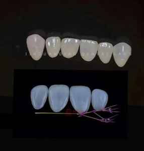 Naturel à la recherche de Max tous les placages de porcelaine céramique pont de couronne avec coût de laboratoire <span class=keywords><strong>dentaire</strong></span> - Product Image 3