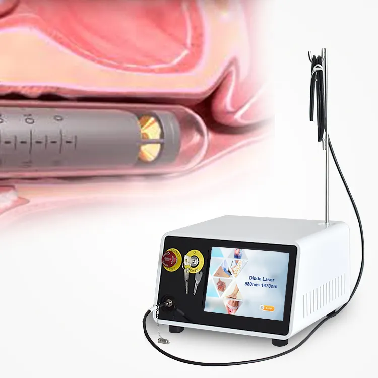 2024 laser vaginal médical 980nm + 1470nm laser blanchiment vaginal laser machine de serrage vaginal