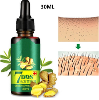 Losion Serum pelurus rambut, minyak Losion Serum penumbuh rambut, menipiskan rambut dan rambut rontok