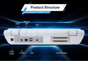 콘텍 CMS1700B 15인치 초음파 USG 기기 휴대용 - Product Image 3
