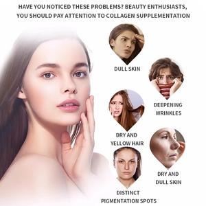 อาหารเสริมคอลลาเจนเปปไทด์สำหรับผู้หญิง OEM ช่วยชะลอวัย บำรุงผม ผิว เล็บ และสุขภาพข้อต่อ - Product Image 2