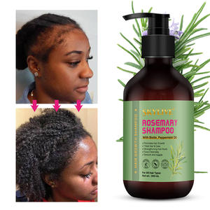 Vente en gros de cheveux d'huile de ricin noire biologique Natrual Ensemble de shampoing pour le renforcement des cheveux Miele Romarin Menthe Produits de croissance des cheveux - Product Image 4