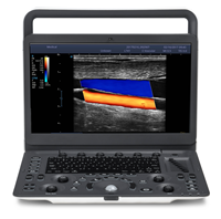 Sonoscape E2V diagnostic précis et efficace calcul automatique échographie vétérinaire doppler couleur haute résolution