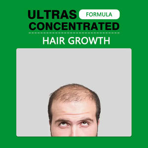 Capsules Premium pour la Croissance des Cheveux avec Palmier Nain, Ashwagandha, Biotine, Collagène Marin, 21 Vitamines et Minéraux pour l'Épaisseur des Cheveux - Product Image 5