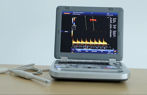 Equipo de Ultrasonido Portátil para el Corazón y Vascular Humano, Máquina de Ecografía Doppler Color CW - Product Image 2