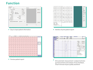 Draagbare Medische 3-kanaals Ekg Monitor Veterinaire Driekanaals <span class=keywords><strong>Ecg</strong></span>-Machineapparatuur - Product Image 3