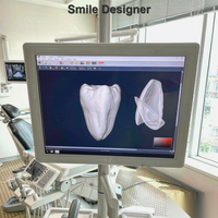 Perangkat Lunak Desain Fotografi Gigi Profesional Smile Designer Pro