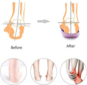 Semelles orthopédiques 3/4, supports de voûte plantaire élevés, semelles pour fasciite plantaire, pieds plats, hyperpronation, soulagement de la douleur de l'<span class=keywords><strong>épine</strong></span> <span class=keywords><strong>calcanéenne</strong></span>. - Product Image 5