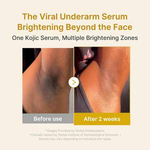 Sérum éclaircissant pour le visage Medicube à l'acide kojique, au curcuma et à la niacinamide 30 ml - Product Image 4