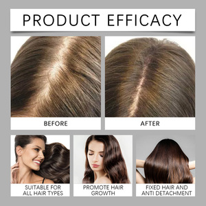 100% <span class=keywords><strong>HUILE</strong></span> BATANA NON RAFFINÉE pour les pertes de <span class=keywords><strong>cheveux</strong></span> Sain Cuir Chevelu Résistance des <span class=keywords><strong>cheveux</strong></span> Plus Long Anti Detangle Curl Sec Usage domestique Absorber Facilement - Product Image 2