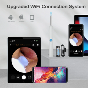 Visual Ear Scooper Smart WIFI Conexión directa HD Children's Ear Scooper God Iluminado Visual Ear Caving Spoon Earwax Cleaner - Product Image 5