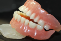 <span class=keywords><strong>Résine</strong></span> liquide dentaire spéciale YIDIMU à haute résistance à l'usure pour imprimante 3D dentaire LCD/DLP, pour l'impression 3D de couronnes et de bridges temporaires - Product Image 2